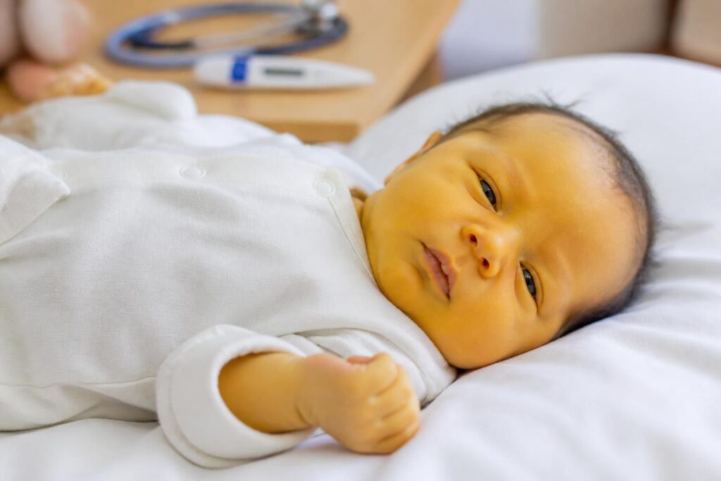 découvrez quand la jaunisse chez le nourrisson nécessite une attention médicale, ses causes principales et les signes à surveiller pour assurer la santé de votre bébé.